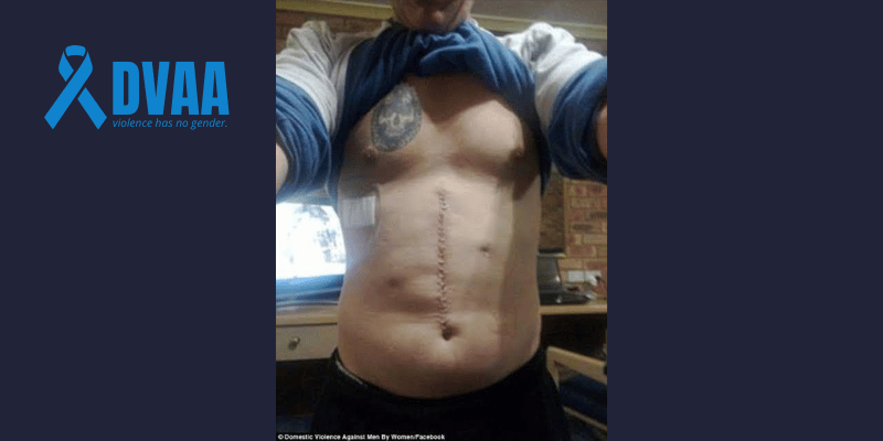 Simon Lanham Was Stabbed 5 Times, He Miraculously Survived — and Still Treated Like the Offender